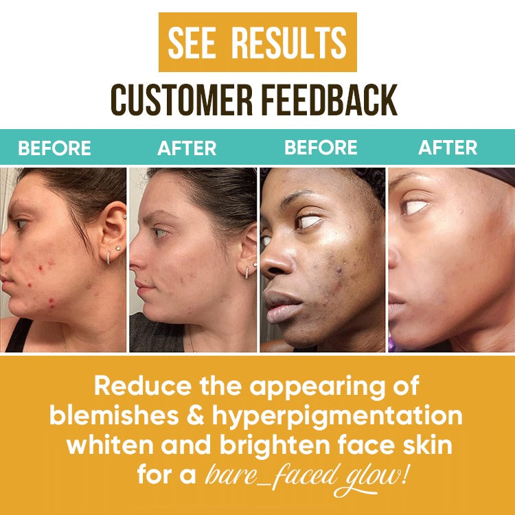 Gloden Glow: The Ultimate Turmeric, Niacinamide & Hyaluronic Acid Face Cream