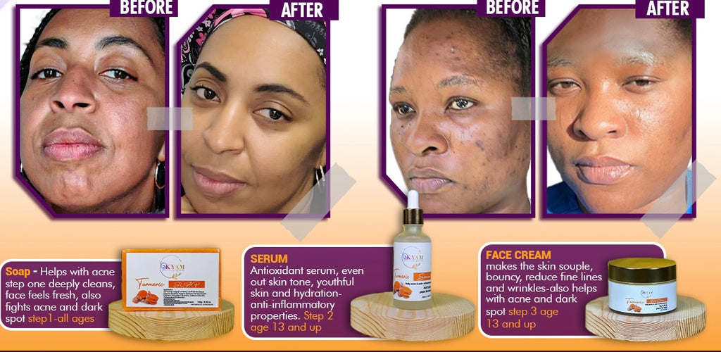 Gloden Glow: The Ultimate Turmeric, Niacinamide & Hyaluronic Acid Face Cream